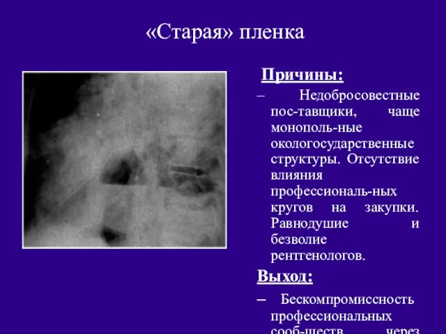 «Старая» пленка Причины: Недобросовестные пос-тавщики, чаще монополь-ные окологосударственные структуры. Отсутствие