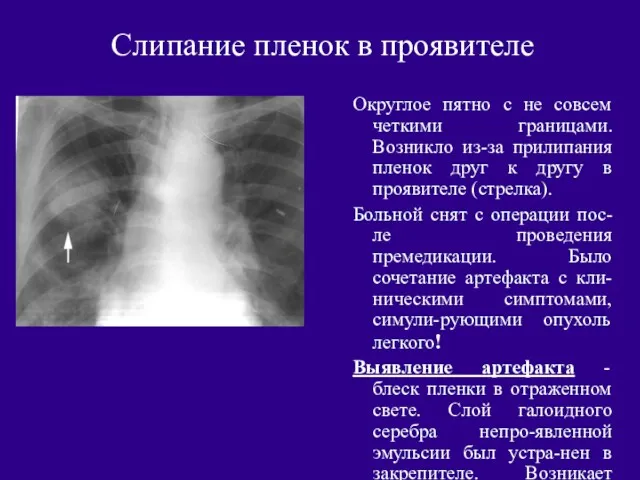 Слипание пленок в проявителе Округлое пятно с не совсем четкими