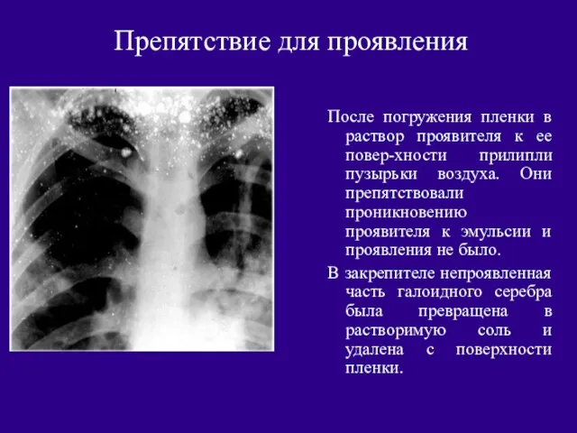 Препятствие для проявления После погружения пленки в раствор проявителя к