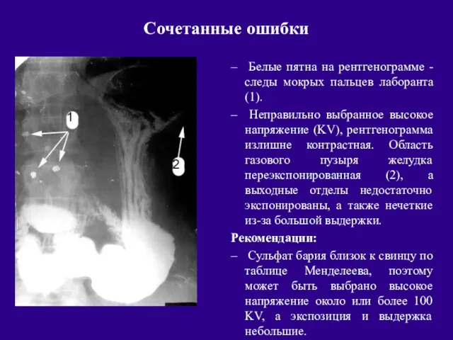 Сочетанные ошибки Белые пятна на рентгенограмме - следы мокрых пальцев