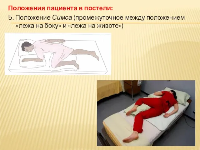 Положения пациента в постели: 5. Положение Симса (промежуточное между положением