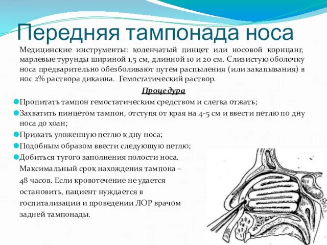 Передняя тампонада носа Медицинские инструменты: коленчатый пинцет или носовой корнцанг,