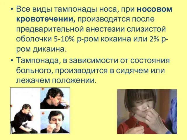 Все виды тампонады носа, при носовом кровотечении, производятся после предварительной