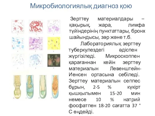 Микробиологиялық диагноз қою Зерттеу материалдары – қақырық, жара, лимфа түйіндерінің