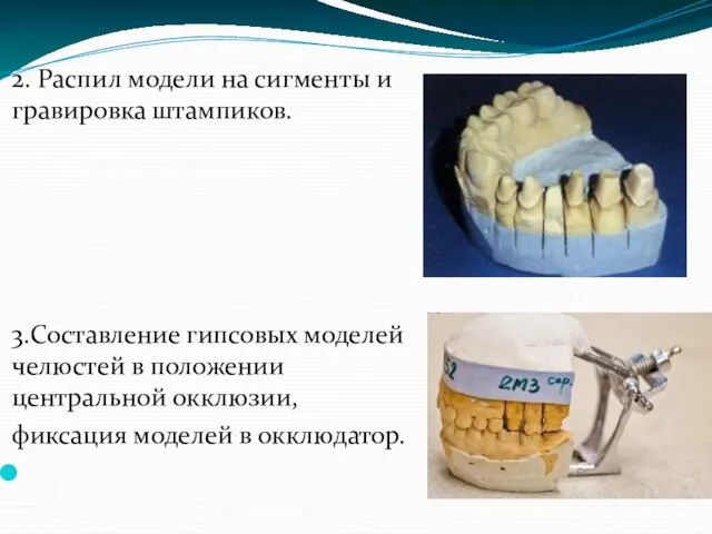 2. Распил модели на сигменты и гравировка штампиков. 3.Составление гипсовых моделей челюстей в