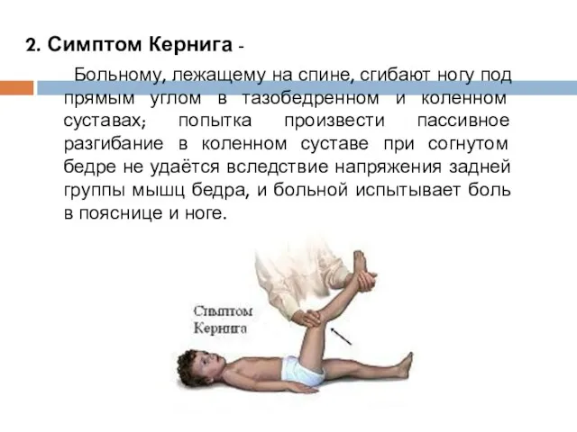 2. Симптом Кернига - Больному, лежащему на спине, сгибают ногу под прямым углом