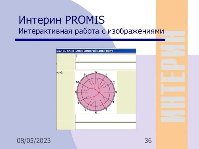 08/05/2023 Интерин PROMIS Интерактивная работа с изображениями Для анимации 1 Для анимации 2