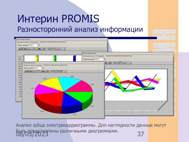 08/05/2023 Интерин PROMIS Разносторонний анализ информации Анализ зубца электрокардиограммы. Для