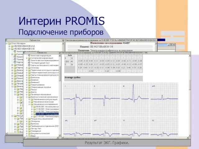 08/05/2023 Интерин PROMIS Подключение приборов