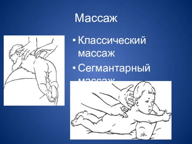 Массаж Классический массаж Сегмантарный массаж Точечный массаж