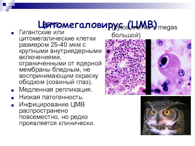 Цитомегаловирус (ЦМВ) ВГЧ5. Гигантские или цитомегалические клетки размером 25-40 мкм