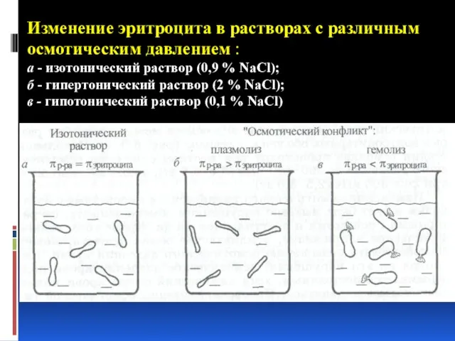 Изменение эритроцита в растворах с различным осмотическим давлением : а