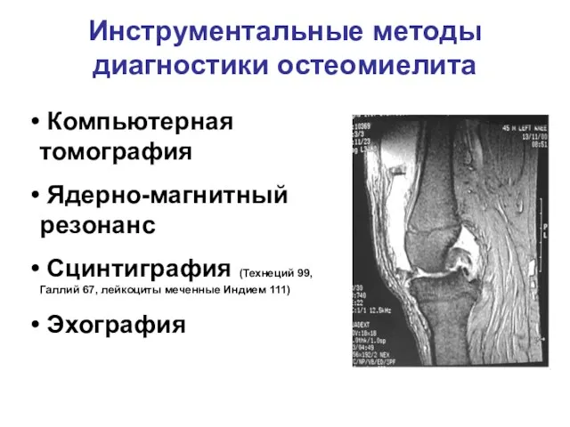 Инструментальные методы диагностики остеомиелита Компьютерная томография Ядерно-магнитный резонанс Сцинтиграфия (Технеций 99, Галлий 67,