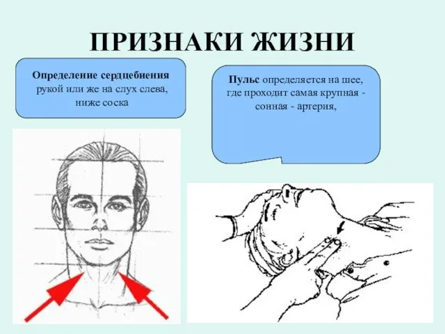 ПРИЗНАКИ ЖИЗНИ Определение сердцебиения рукой или же на слух слева,