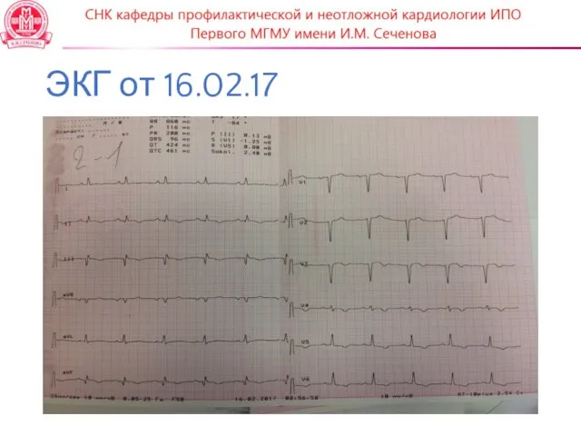 ЭКГ от 16.02.17