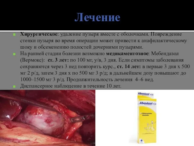 Лечение Хирургическое: удаление пузыря вместе с оболочками. Повреждение стенки пузыря