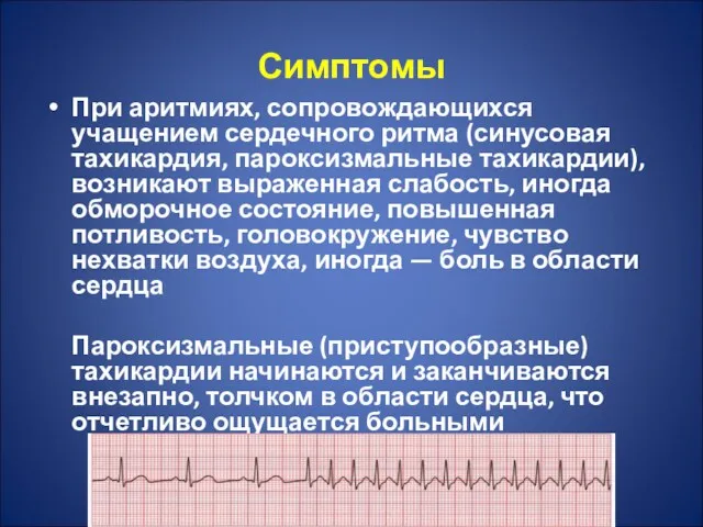 Симптомы При аритмиях, сопровождающихся учащением сердечного ритма (синусовая тахикардия, пароксизмальные