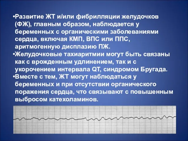 Развитие ЖТ и/или фибрилляции желудочков (ФЖ), главным образом, наблюдается у