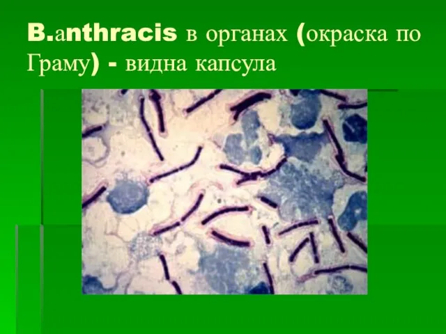 B.аnthracis в органах (окраска по Граму) - видна капсула