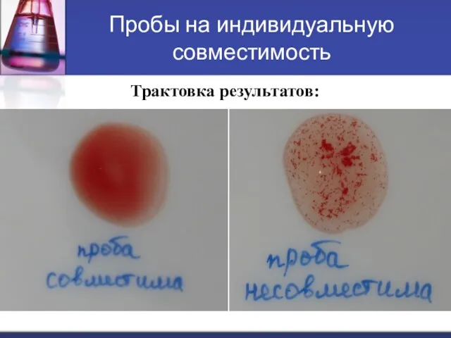 Пробы на индивидуальную совместимость Трактовка результатов: