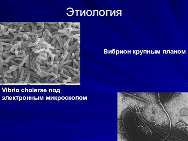 Этиология Vibrio cholerae под электронным микроскопом Вибрион крупным планом