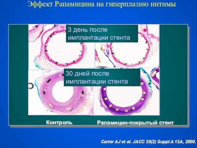 Контроль Рапамицин-покрытый стент Carter AJ et al. JACC 35(2) Suppl