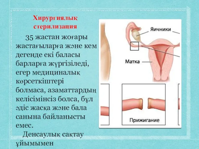 Хирургиялық стерилизация 35 жастан жоғары жастағыларға және кем дегенде екі