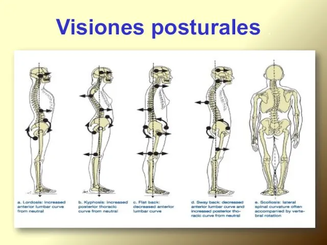 Visiones posturales .