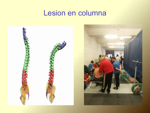 Lesion en columna