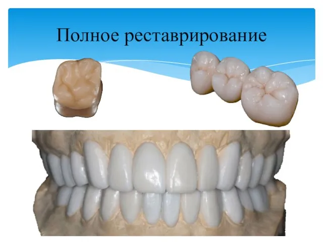 Полное реставрирование