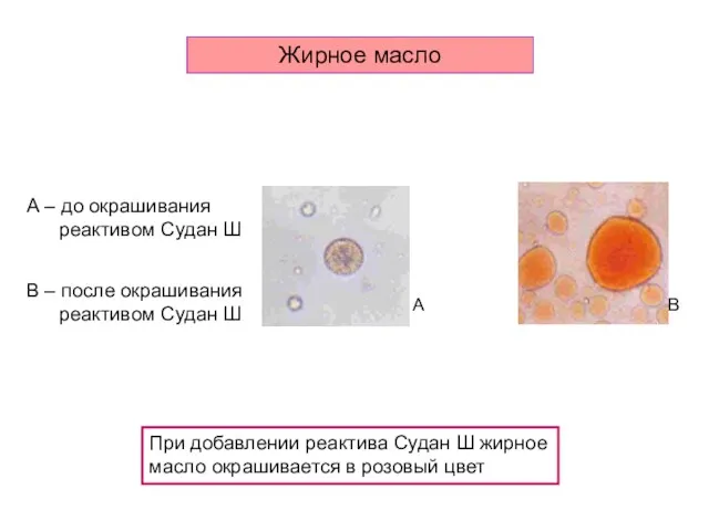 А – до окрашивания реактивом Судан Ш В – после