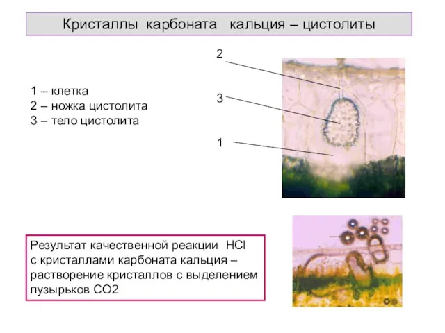 Кристаллы карбоната кальция – цистолиты 2 3 1 1 –