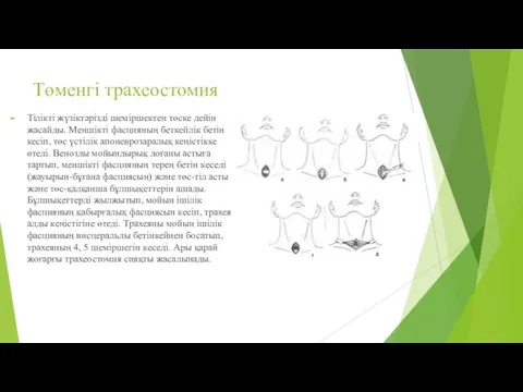 Төменгі трахеостомия Тілікті жүзіктәрізді шеміршектен төске дейін жасайды. Меншікті фасцияның