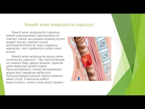 Көмей және кеңірдектің тарылуы Көмей және кеңірдектің тарылуы – көмей