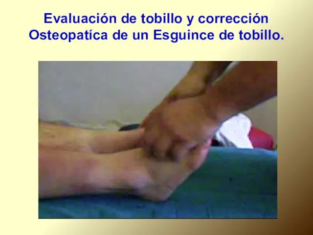 Evaluación de tobillo y corrección Osteopatíca de un Esguince de tobillo.
