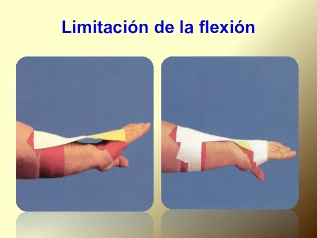 Limitación de la flexión