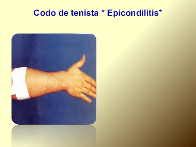 Codo de tenista * Epicondilitis*