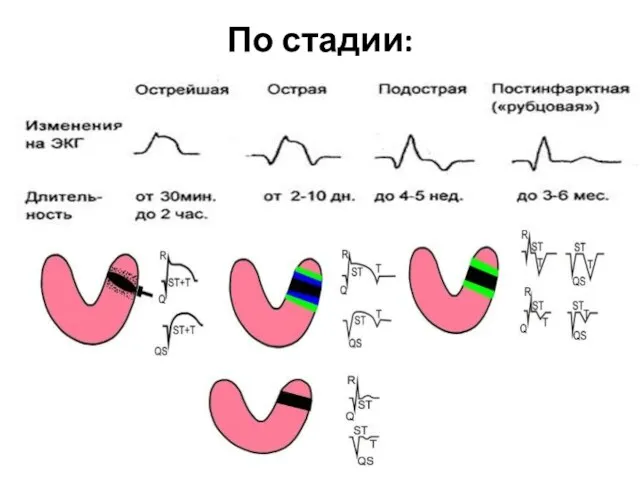 По стадии: