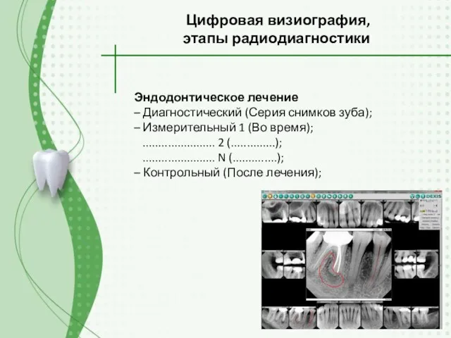 Эндодонтическое лечение – Диагностический (Серия снимков зуба); – Измерительный 1