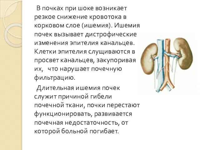 В почках при шоке возникает резкое снижение кровотока в корковом