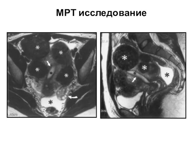 МРТ исследование