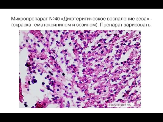 Микропрепарат №40 «Дифтеритическое воспаление зева» - (окраска гематоксилином и эозином). Препарат зарисовать. Увеличение х 400