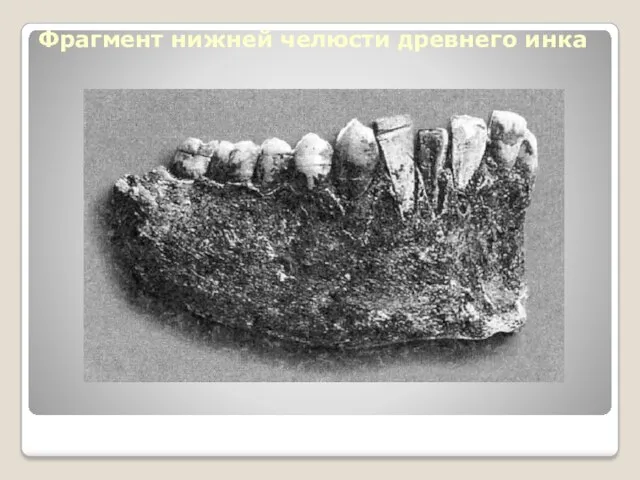 Фрагмент нижней челюсти древнего инка