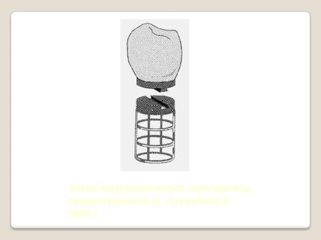 Эскиз внутрикостного имплантата, предложенного U. Greenfield в 1909 г.