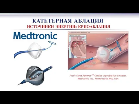 КАТЕТЕРНАЯ АБЛАЦИЯ ИСТОЧНИКИ ЭНЕРГИИ: КРИОАБЛАЦИЯ Arctic Front AdvanceTM Cardiac Cryoablation Catheter, Medtronic, Inc., Minneapolis, MN, USA
