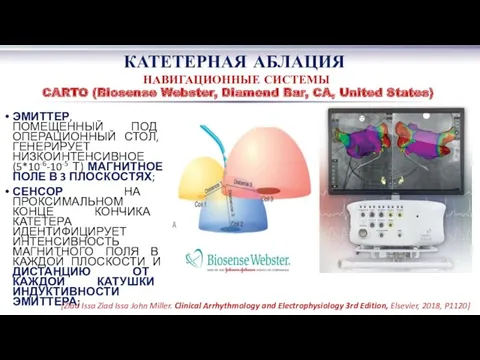 КАТЕТЕРНАЯ АБЛАЦИЯ НАВИГАЦИОННЫЕ СИСТЕМЫ CARTO (Biosense Webster, Diamond Bar, CA,