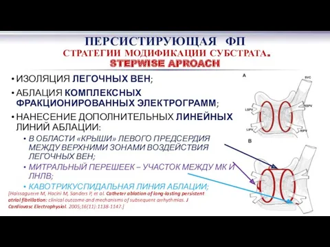 ИЗОЛЯЦИЯ ЛЕГОЧНЫХ ВЕН; АБЛАЦИЯ КОМПЛЕКСНЫХ ФРАКЦИОНИРОВАННЫХ ЭЛЕКТРОГРАММ; НАНЕСЕНИЕ ДОПОЛНИТЕЛЬНЫХ ЛИНЕЙНЫХ