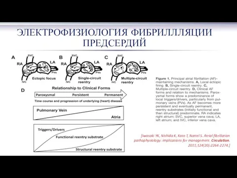 ЭЛЕКТРОФИЗИОЛОГИЯ ФИБРИЛЛЛЯЦИИ ПРЕДСЕРДИЙ [Iwasaki YK, Nishida K, Kato T, Nattel