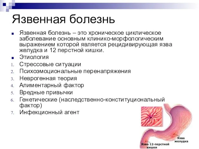 Язвенная болезнь Язвенная болезнь – это хроническое циклическое заболевание основным