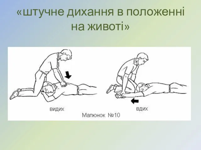 «штучне дихання в положенні на животі»